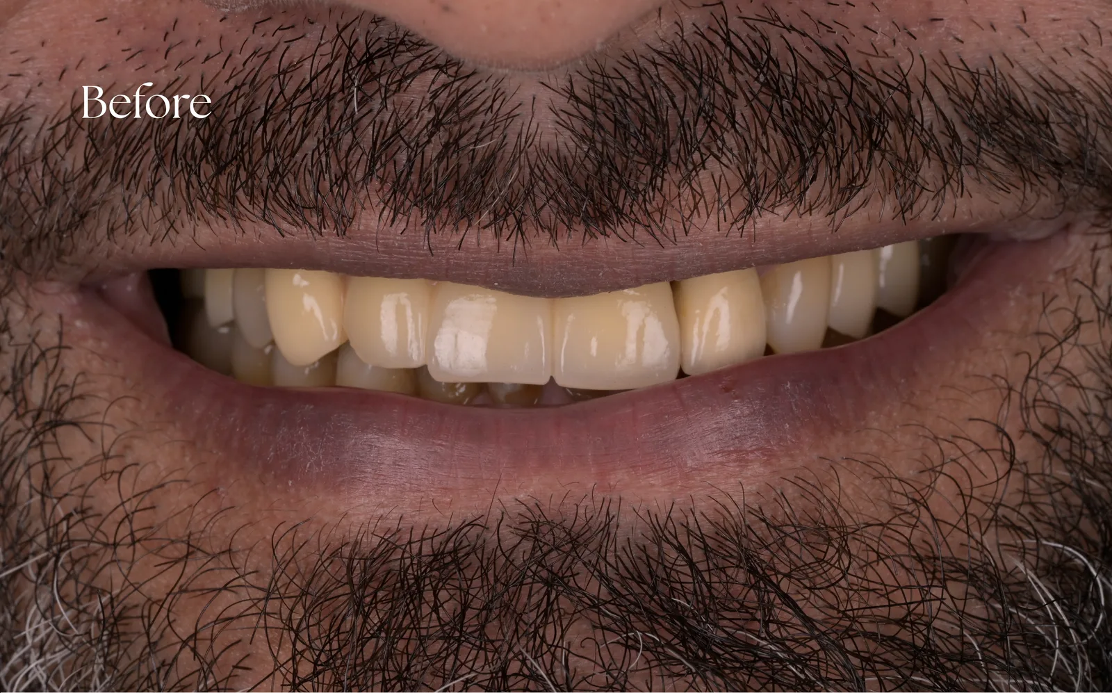 صورة ما قبل العلاج — case-002