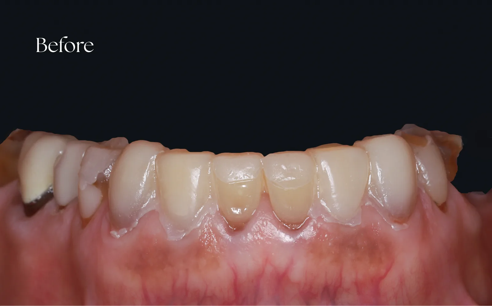 صورة ما قبل العلاج — case-005